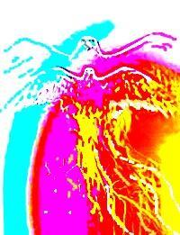 Неведенье