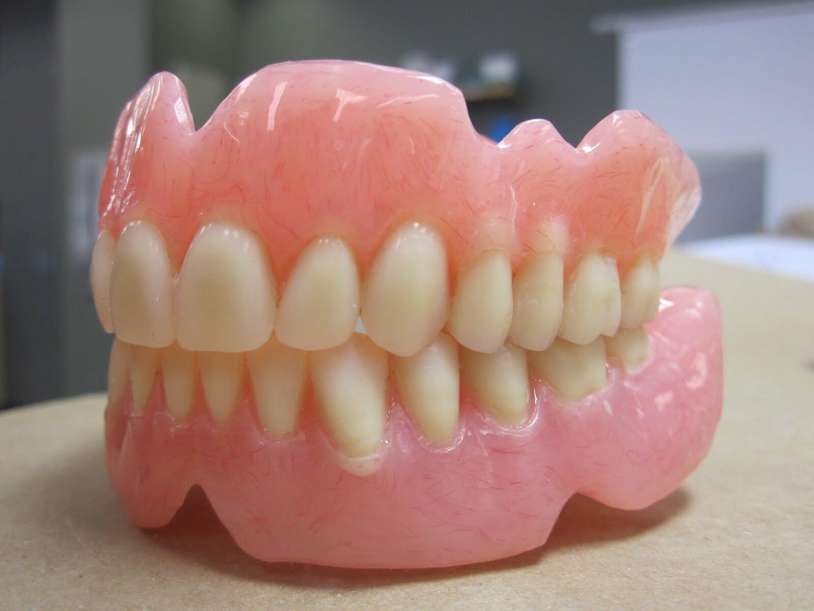 Протезирование зубов в казани. Полносъемный протез акрил. Пластмассовые зубные протезы. Полный съемный протез из пластмассы. Вставная челюсть.