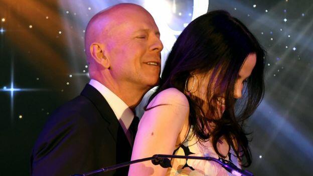 К вопросу облысения