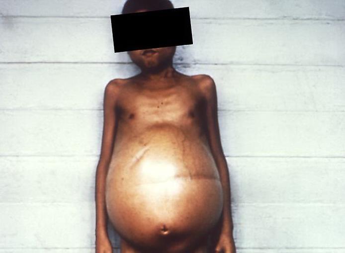 Паразитизм