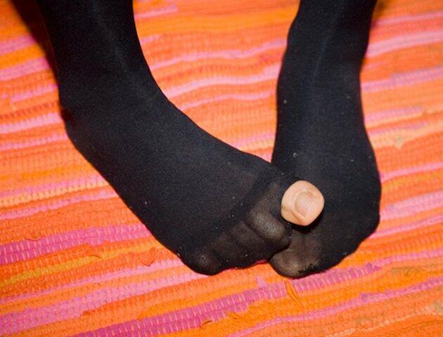 Дырявый носок на ноге