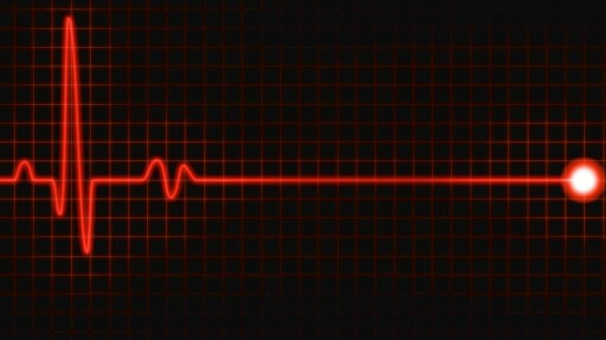 ЧТО ВЫ НАДЕЛАЛИ !