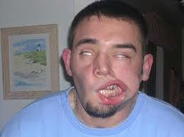 Экс на коммент под своим стихом Александра Жука "ДАЮТ СОВЕТ - ЛИМОН - ХОРОШИЙ СТИМУЛ!.."