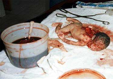 И губы шепчут тихо: " МАМА"