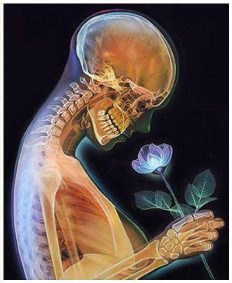 Как-то вот так...