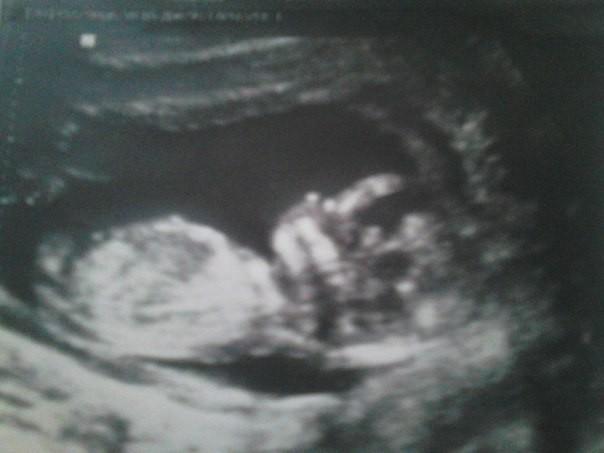 ПОД СЕРДЦЕМ