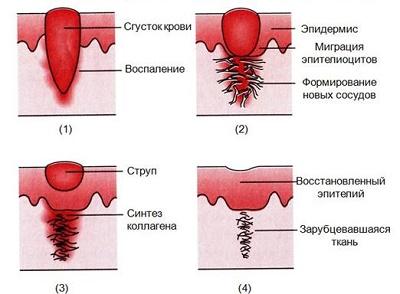 Регенерация от травмы